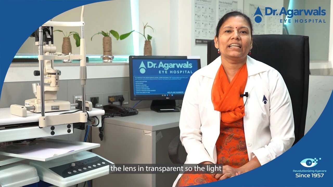 Doctor Speaks: All about Cataracts