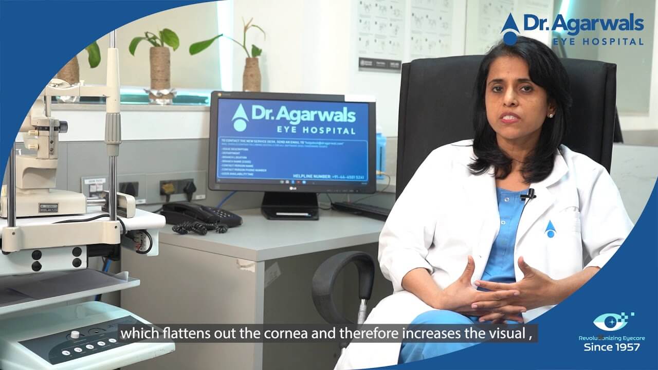 Doctor Speaks: All about Keratoconus